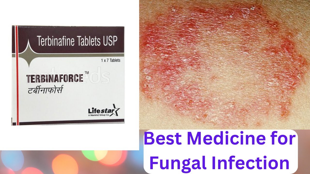 Terbinafine TABLET Exposed! What The Doctors Don't Tell You