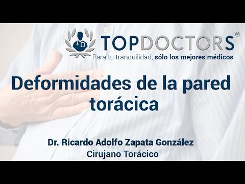 Pectus excavatum y Pectus carinatum: deformidades de la cavidad torácica