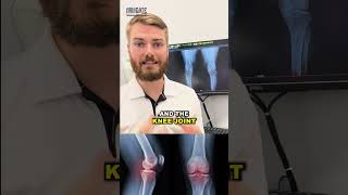 Why You Should Get An X-Ray If You Have Knee Pain Why You Should Get An X-Ray If You Have Knee Pain