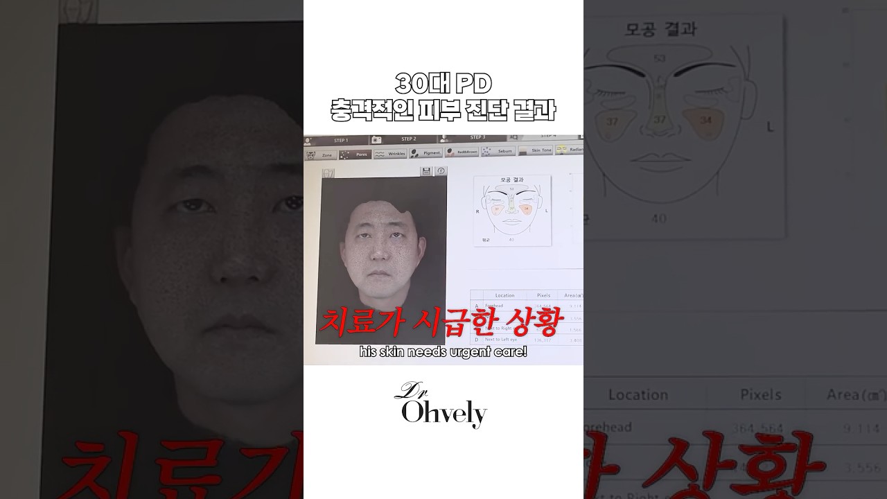 30대인데 피부 나이 43세 나왔습니다😱 어플보다 정확한 피부 진단의 충격 #shorts