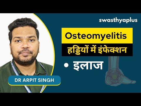 हड्डियों में इंफेक्शन क्या है इलाज? | Bone Infections/ Osteomyelitis in Hindi | Dr Arpit Singh