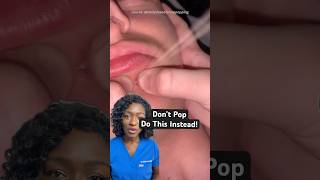 Stop Popping Your Pimples - Do This Instead!