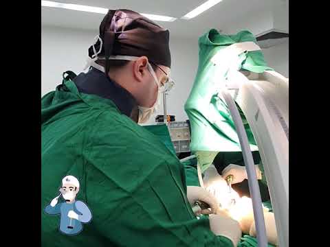 Vídeo: A Influência Da Experiência Da Cirurgia Assistida Por Computador Na Precisão E Precisão Do Eixo Mecânico Pós-operatório Durante A Osteotomia Tibial Alta De Cunha De Fechamento Late