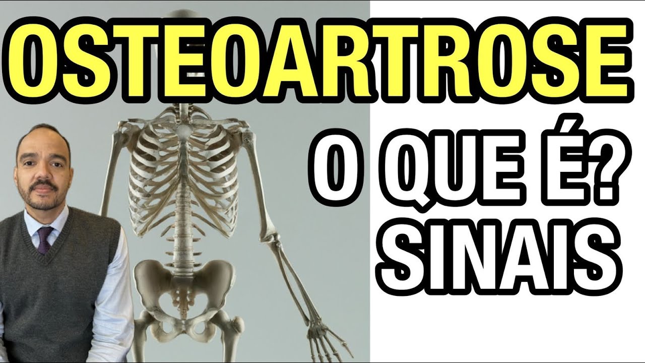 OSTEOARTROSE: O QUE É, SINTOMAS, DIAGNÓSTICO E TRATAMENTO, image size:1280x720