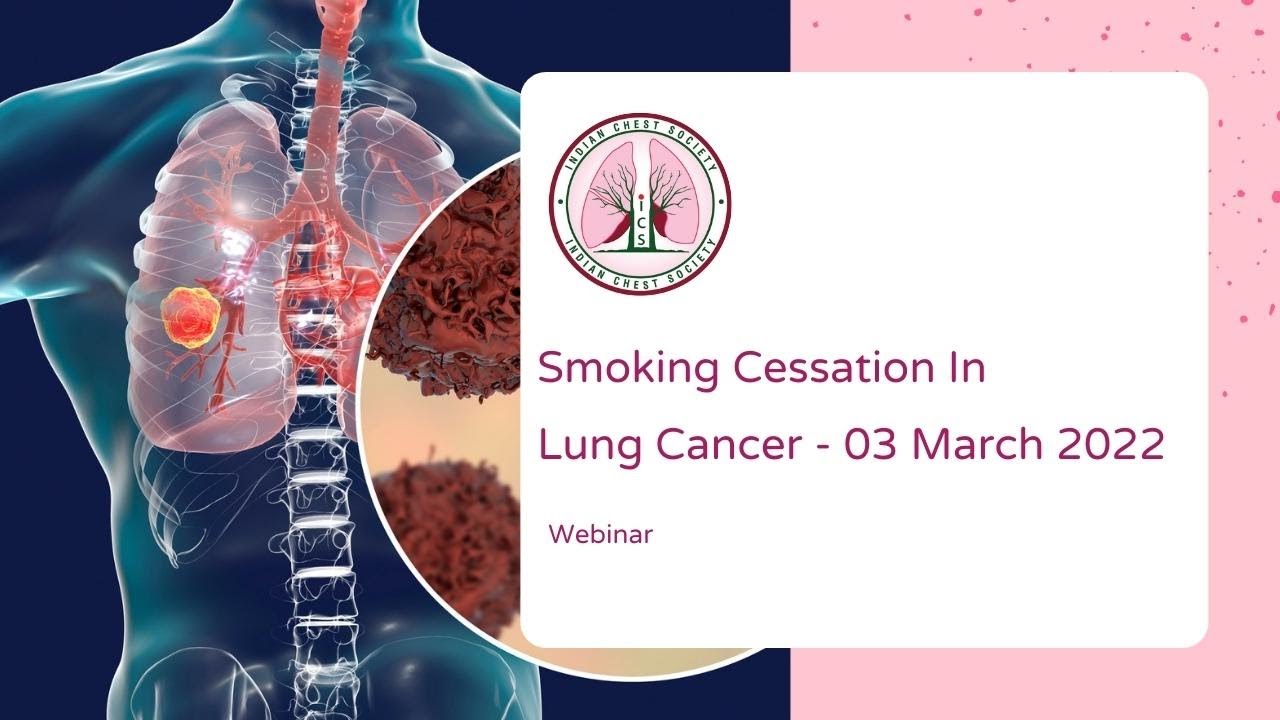 inar on Smoking Cessation in Lung Cancer YouTube