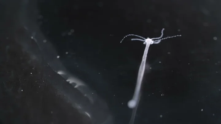 The Undying Hydra A Freshwater Mini Monster That Defies Aging  Deep Look
