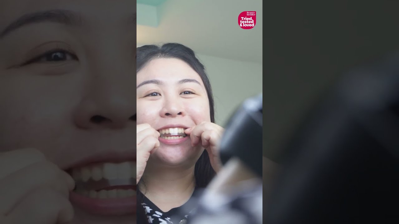 Smile Makeover: iWhite Whitening Strips Review! 💫