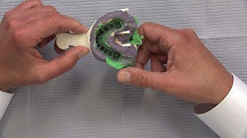 Chairside Live Episode 72: What Good is a Double-Arch Technique when the Bite is Off?