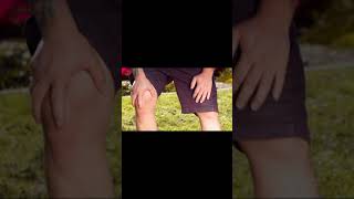 Shorts Paralysis लकव Faint बहश