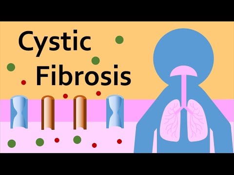 Cystic Fibrosis and the Mucociliary System