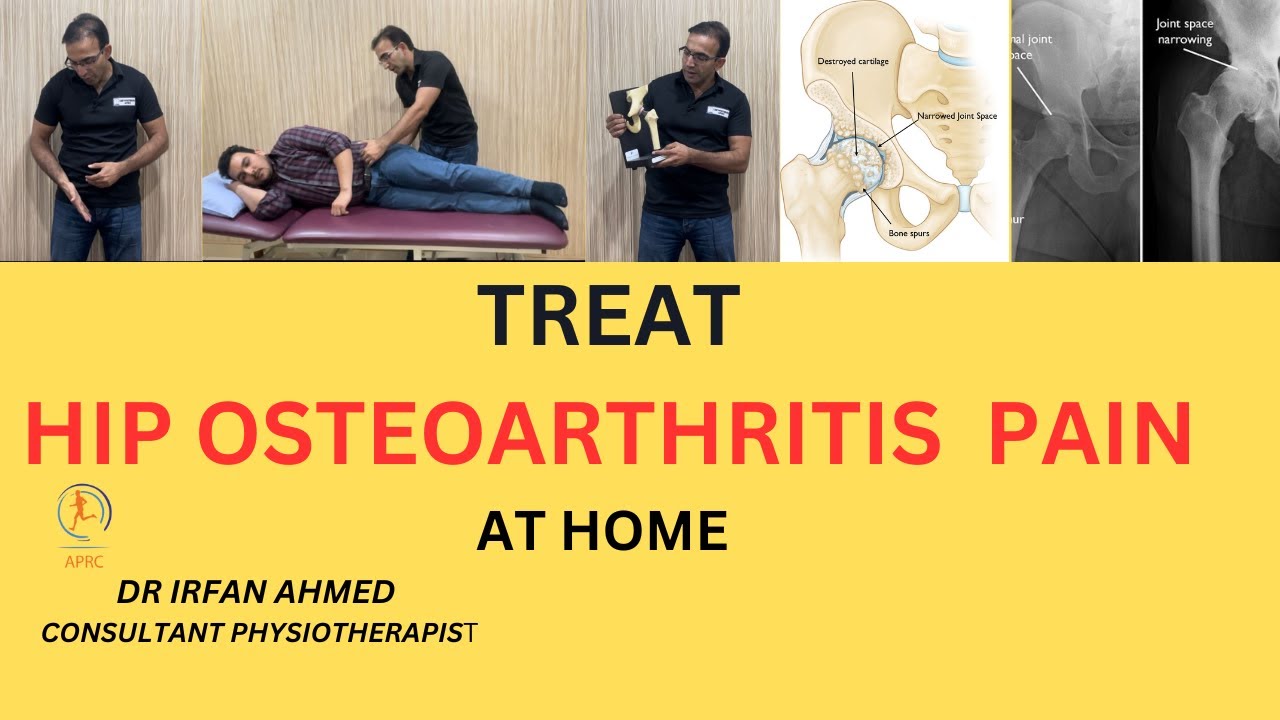 Learn and Treat Hip Osteoarthritis at Home Top 6 Exercises for Hip