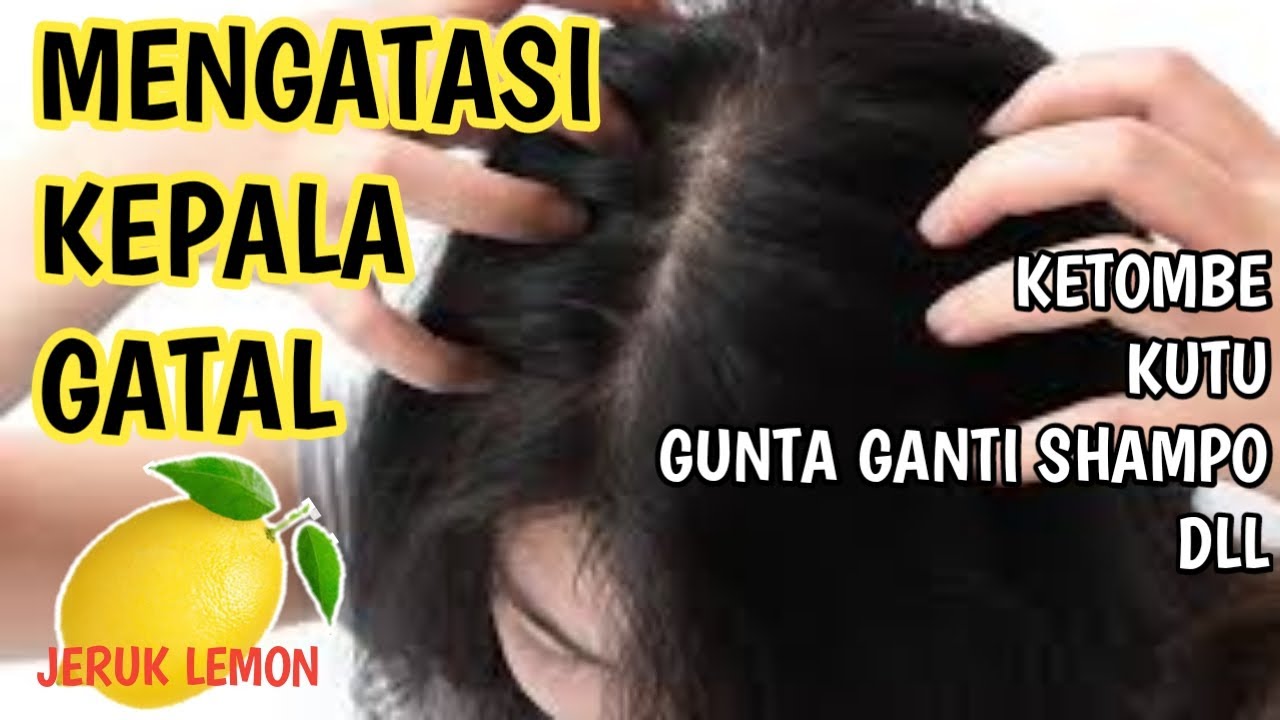 Cara mengatasi kepala gatal 