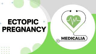 Ectopic pregnancy ( part 2 ) : 1-Pathology 2-Fate 3-clinical picture of undisturbed type.