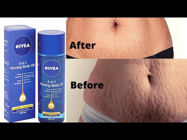 Nivea Q10 Body Oil Firming +Stretch Marks 200ml /Q10 Body Oil for Women  skin Reduces strength Marks - YouTube