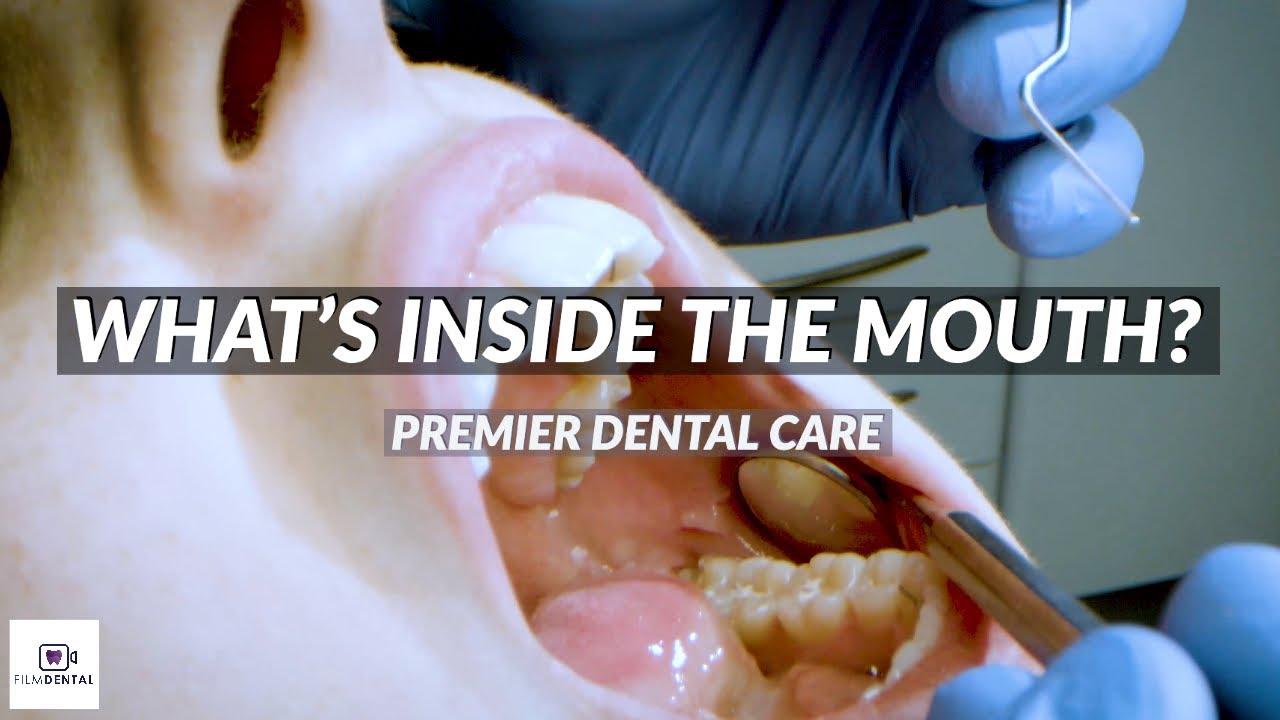 PREMIER DENTAL CARE YouTube