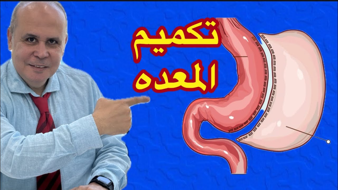 احذروا من عمليات التكميم للمعده