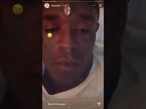 Lil Uzi Vert Gets 24 Million Dollar Pink Diamond Attached To His Forehead