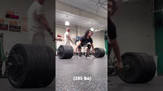 Deadlifts Until My Hands Bleed Ripped A Callus