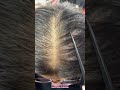 Alopecia Androgenica Femenina y Caspa Seca