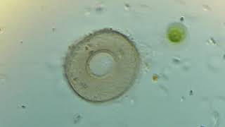 Testate amoebe (Arcella), under oblique illumination