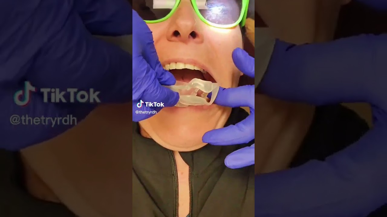 DENTAL MV – UMBRELLA