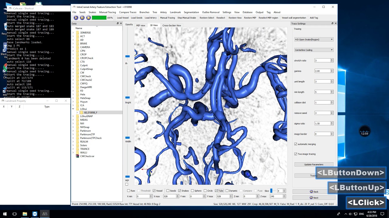 Icafe Software iCafe demo #6 - YouTube