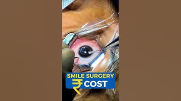 Smile Surgery Cost