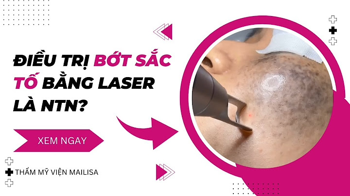 Bắn laser trị bớt sắc tố bao nhiêu tiền