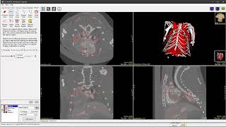 Analyze 14 Overview: New Features and Enhancements