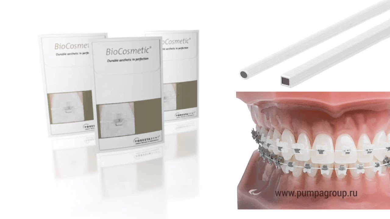 Брекеты QuicKlear с металлической клипсой