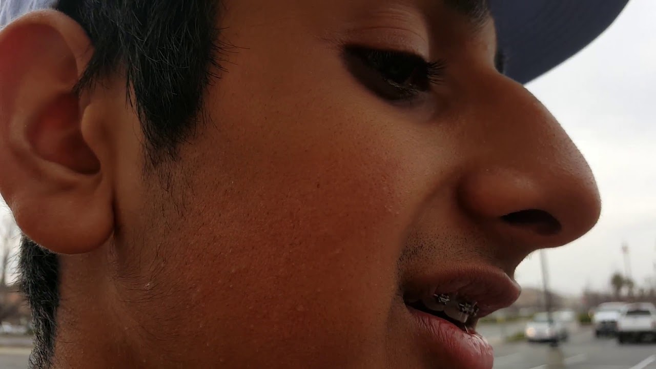 please stop calling me gay - skate life