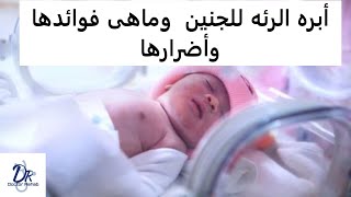 أبره الرئه للجنين  وماهى فوائدها وأضرارها