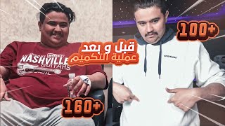 قصتي مع عملية التكميم ونصايح تهمكم 😍👍🏻