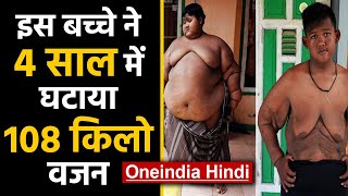 World का सबसे मोटा Child अब हो गया दुबला | Oneindia Hindi