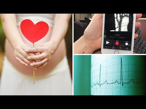 Video: Wann kann ich den Herzschlag meines ungeborenen Kindes hören?