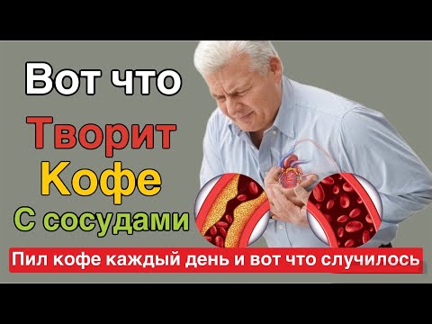 Смотрите что творит КОФЕ с СОСУДАМИ ! Реакция сосудов на КОФЕ вас очень удивит!