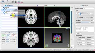 MI-Brain - Filter streamlines using a cuboid selection object