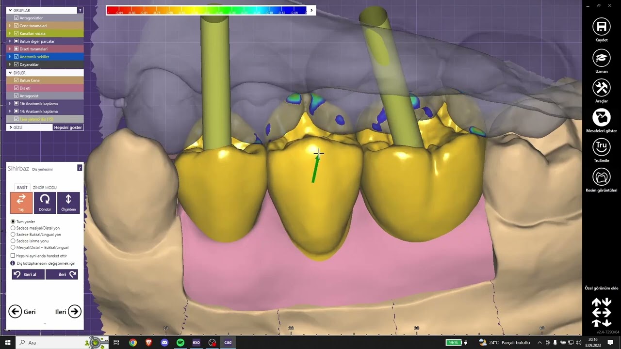 Exocad İmplant Altyapı Tasarımı | Substructure Implant Design in Exocad
