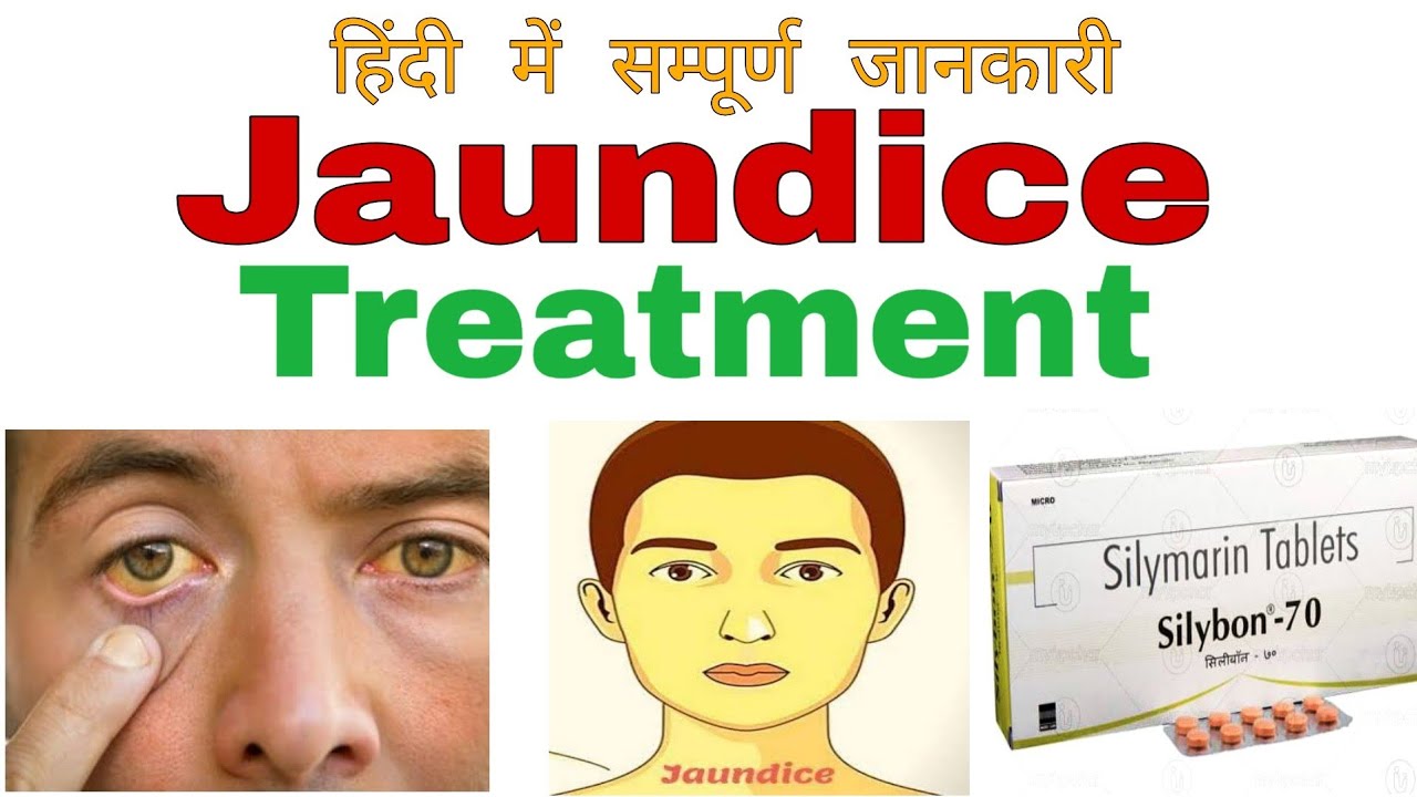 Jaundice treatment in hindi Medicines used in Jaundice Jaundice me