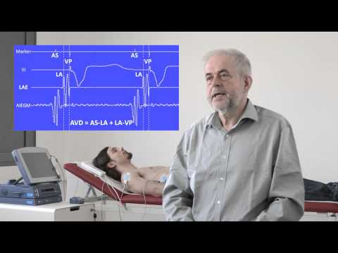 Hämodynamische Implantatoptimierung mittels