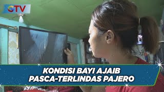 Kondisi Terkini Balita Terlindas Mobil Mewah di Makassar - BIP 06/09 screenshot 5