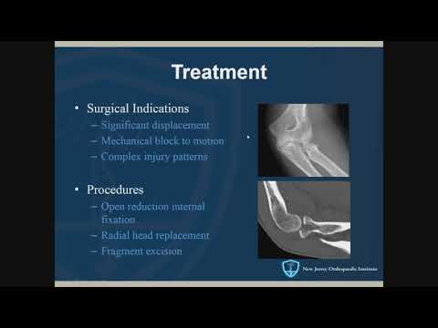 Video: Fracture Of The Elbow Joint