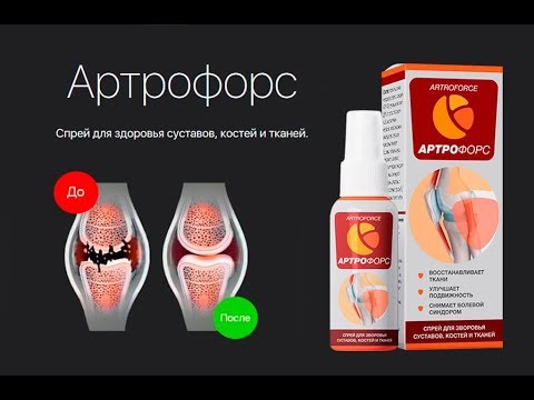 Артрофорс Развод Или Правда | Артрофорс Спрей Отзывы - YouTube