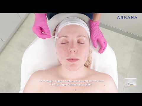 AzAc Peeling - Ein Peeling mit Azelainsäure - TUTORIAL