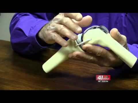 3D Customizable Knee Implant