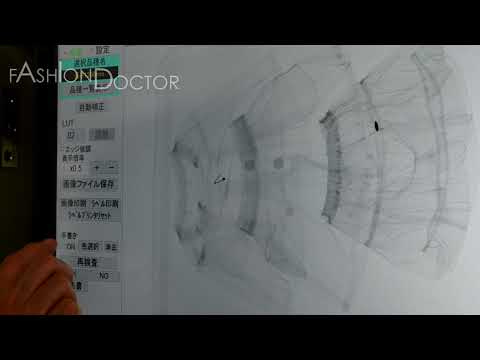 PR動画 AI X線検査機 桑原本社ライン 公開版  20230714