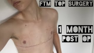 1 month post op - FtM Top Surgery