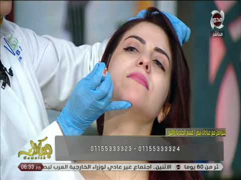 جمالك يعني إيه فيلر وإيه المناطق إللي الفيلر بيعالجها مع د نهلة الهيميسي