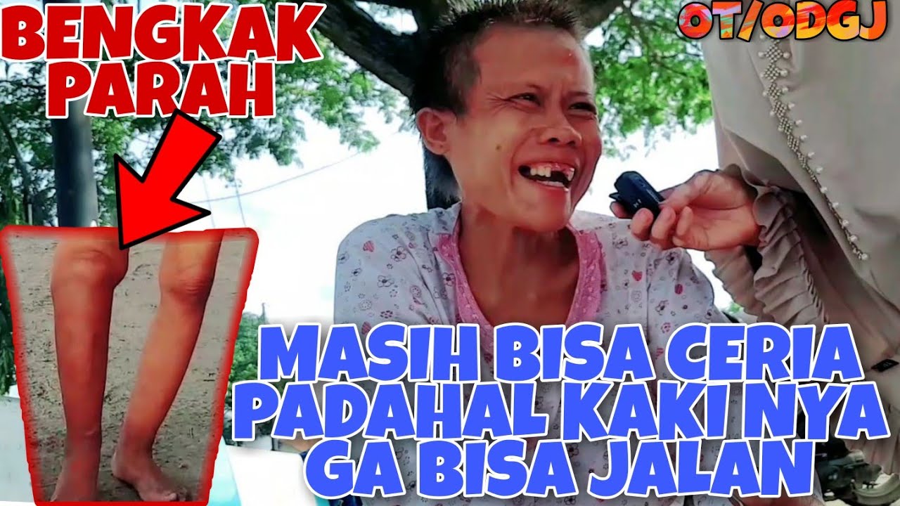 Miris Banget❗ODGJ Cewek Kaki Nya bengkak Pernah dimandikan Oleh Diman Khan tv