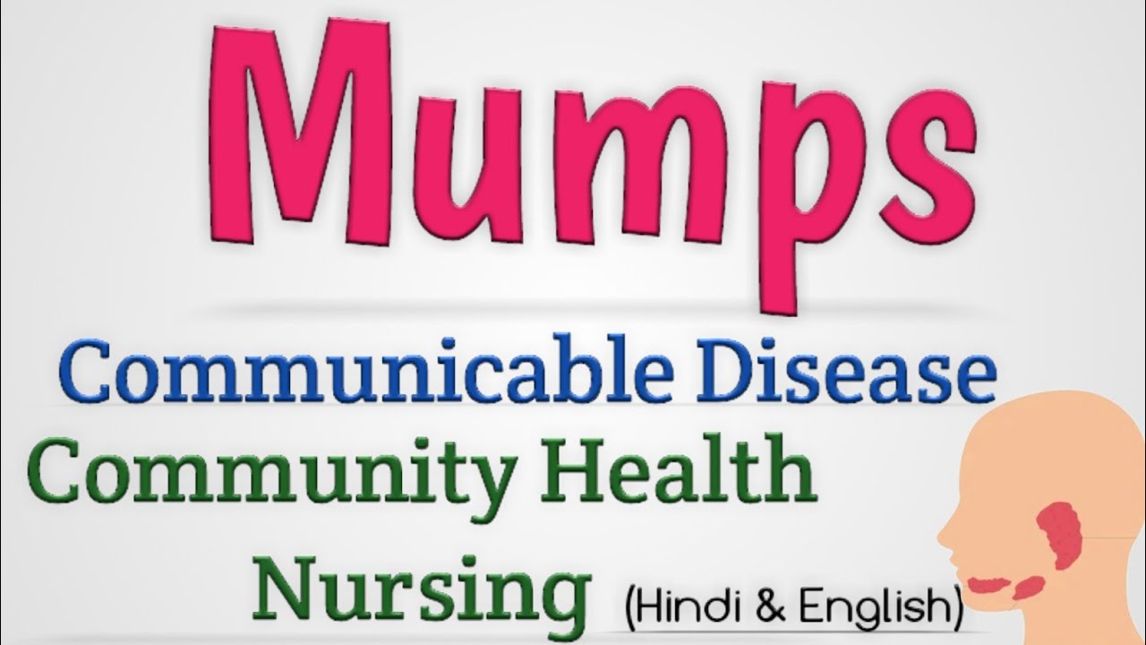 Mumps Viral Disease Mumps In Hindi YouTube